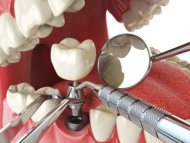 Best 24-Hour Emergency Dentist in Atlanta, GA