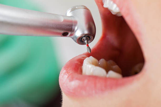 Best Emergency Dental Surgery in Atlanta, GA